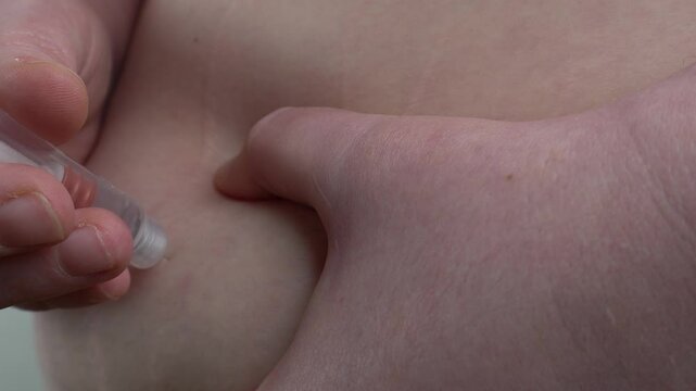 Close-up of a woman injecting insulin or semaglutide into the abdominal cavity. A woman's stomach and a pen for self-injection in a woman's hand. The concept of medicine and treatment
