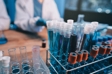 Blood test in the laboratory. Laboratory assistant working with the dispenser. Vacuum tubes with blood.