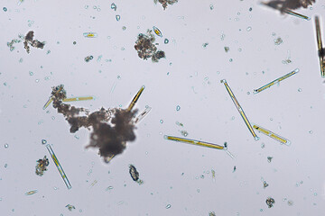 freshwater diatom algae from a river under the microscope - optical microscope x200 magnification