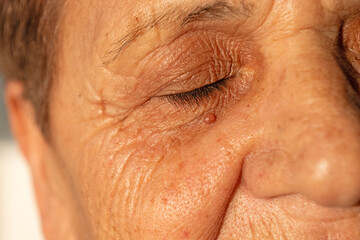 Fototapeta premium Wrinkles and moles around the eyes of an old woman.