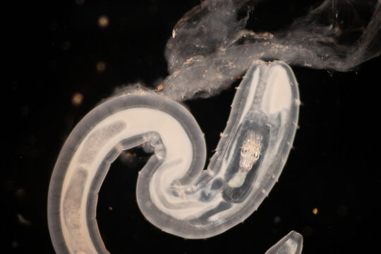Cyctacanth stage (Acanthocephala) fish cestode larva (Trianchoratus sp.) in Channa striata under the microscope in Lab.