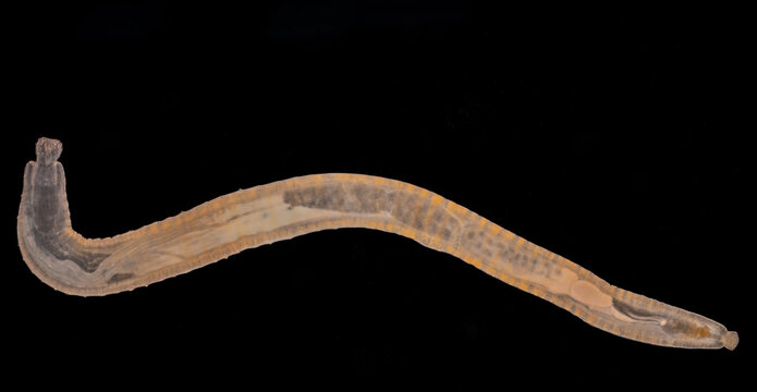 Cyctacanth stage (Acanthocephala) fish cestode larva (Trianchoratus sp.) in Channa striata under the microscope in Lab.