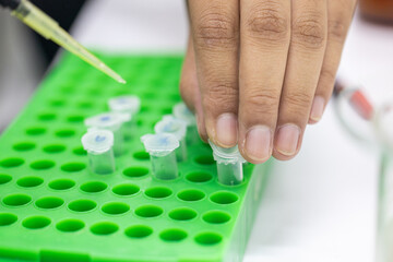 Polymerase Chain Reaction (PCR) and Agarose gel electrophoresis is a method of gel electrophoresis...