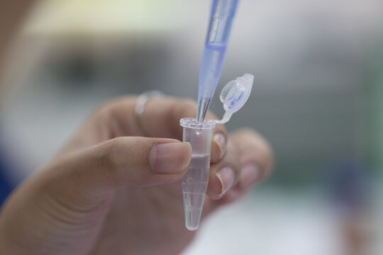 "Gel Electrophoresis" Images – Browse 1,128 Stock Photos, Vectors, and