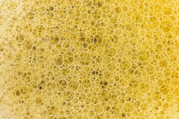 Polymerase Chain Reaction (PCR) and Agarose gel electrophoresis is a method of gel electrophoresis used in biochemistry, molecular biology, genetics, and clinical chemistry in lab.