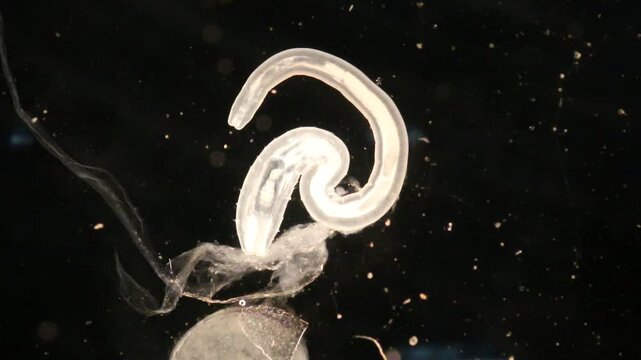 Cyctacanth stage (Acanthocephala) fish cestode larva (Trianchoratus sp.) in Channa striata under the microscope in Lab.
