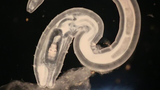 Cyctacanth stage (Acanthocephala) fish cestode larva (Trianchoratus sp.) in Channa striata under the microscope in Lab.