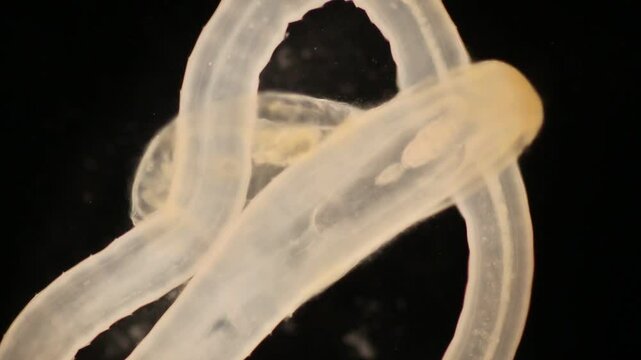 Cyctacanth stage (Acanthocephala) fish cestode larva (Trianchoratus sp.) in Channa striata under the microscope in Lab.