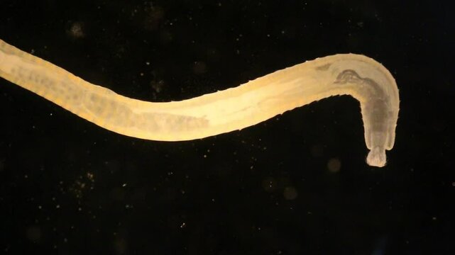 Cyctacanth stage (Acanthocephala) fish cestode larva (Trianchoratus sp.) in Channa striata under the microscope in Lab.