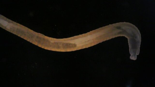 Cyctacanth stage (Acanthocephala) fish cestode larva (Trianchoratus sp.) in Channa striata under the microscope in Lab.