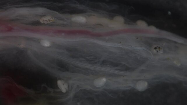 Cyctacanth stage (Acanthocephala) fish cestode larva (Trianchoratus sp.) in Channa striata under the microscope in Lab.