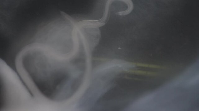 Cyctacanth stage (Acanthocephala) fish cestode larva (Trianchoratus sp.) in Channa striata under the microscope in Lab.