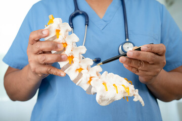 Asian doctor holding spinal nerve and bone model, Lumbar spine displaced herniated disc fragment for treatment medical in the orthopedic department.