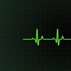 A green electrocardiogram (ECG) line is displayed against a dark grid background, showing a typical heartbeat pattern. The peaks and troughs illustrate the rhythm of the heart.