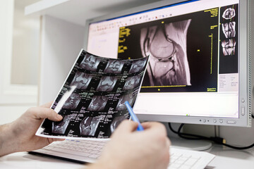 A doctor examines MRI scans in the MRI control room of a modern clinic. Advanced diagnostic...