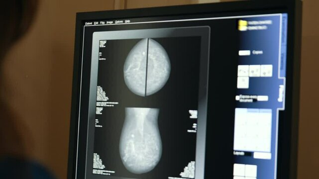 A radiology technician/specialist reviews images on a monitor in the radiology control room. The screen clearly displays a radiology image.