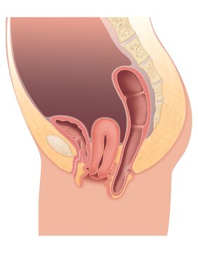 Illustration showing pelvic organs with uterine prolapse in female anatomy, uterus protrudes from normal position