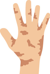 Obraz premium World Leprosy Day Disease Awareness symbol