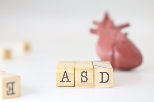 ASD word written on wooden cubes isolated with heart on white background. Atrial Septal Defect concept of cardiology.