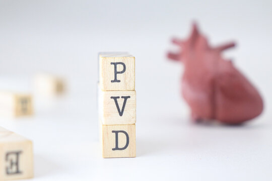 Peripheral artery disease acronym. PVD abbreviation written on wooden cubes isolated with heart on white background with copy space. Concept of health heart