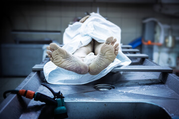 A dead body lays on a table after an autopsy inside a morgue.