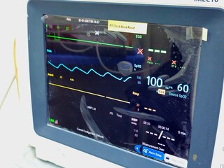 Cairo, Egypt, December 31 2024: Vital signs medical monitor for measurement of important vital...