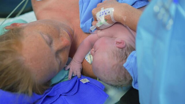 A just-born baby is placed on the mother's chest as the surgeon completes the cesarean section operation. A touching moment of maternal bonding, love, and the first embrace after childbirth in a