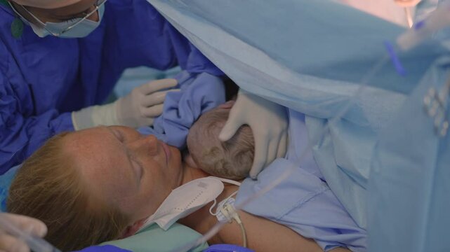A just-born baby is placed on the mother's chest as the surgeon completes the cesarean section operation. A touching moment of maternal bonding, love, and the first embrace after childbirth in a