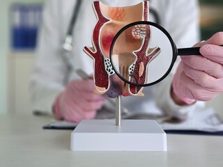 Doctor uses magnifying glass to examine rectal model