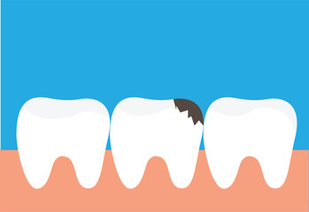 Teeth with Gums Tooth Decay. Health care and medicine concept vector art