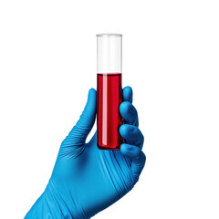 Hand Holding Test Tube with Red Liquid