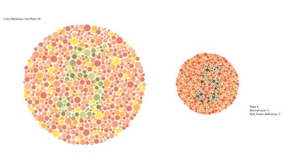 Color vision test or Color Blindness Test Plate 10 and other Plate 6, Normal view 5, Red_Green deficiency: 2. © A.S.Khan