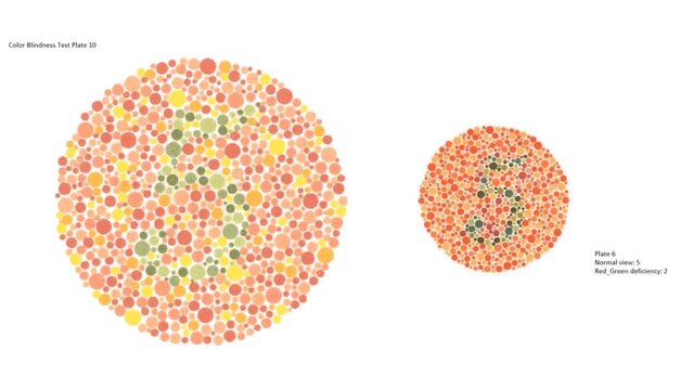 Color vision test or Color Blindness Test Plate 10 and other Plate 6, Normal view 5, Red_Green deficiency: 2.