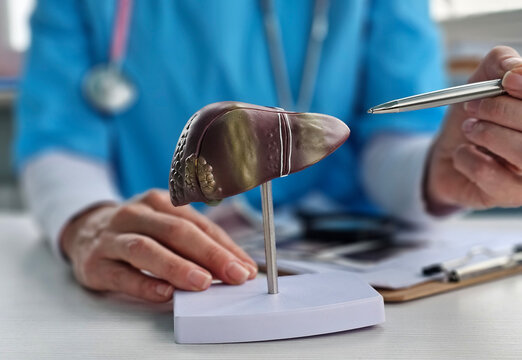 Doctor examines liver model focusing on diseases