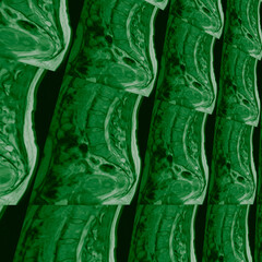 Magnetic resonance imaging of human spinem,background for science