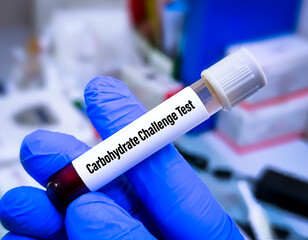 Blood sample for carbohydrate challenge test. OGTT. Glucose Challenge test.