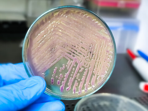 scientist hand holding petri dish with colony of Escherichia coli (E. coli) 