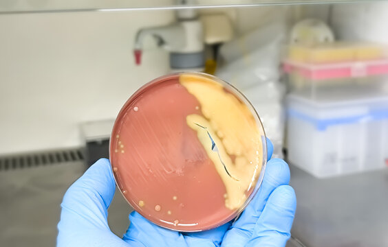 Streptococcus pneumoniae colony in blood agar media on petri dish in doctor hand.