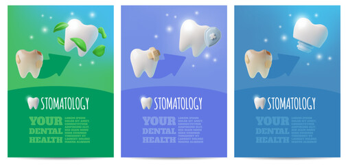 Your dental health advertising poster 3D vector set, bad and good conditions of tooth or implant, stomatology service