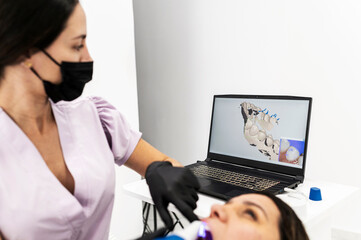 Dentist monitoring 3D dental scan
