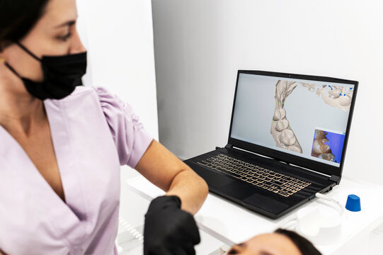 3D dental scan analysis