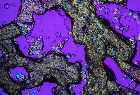 ibuprofen gel with crystal micrograph
