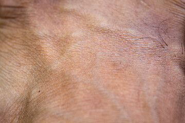 Naklejka premium close up of human skin
