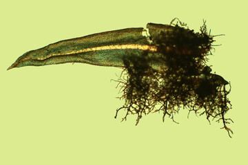 Micrograph of branch leaf of Aulacomnium, with tomentum at 40x.