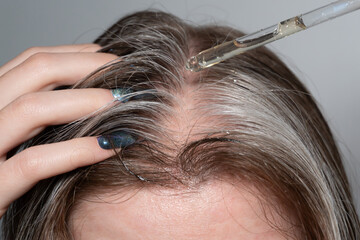 Obraz premium Photo of a hair part with a pipette applying an acid peel or serum to the scalp: A close-up shows the parting of hair, where brown and silver strands intertwine.