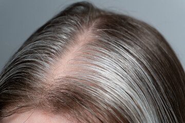 Close-up of brown and gray hair: A detailed shot of the crown of the head shows the smooth texture of the hair, where brown and silvery strands meet.