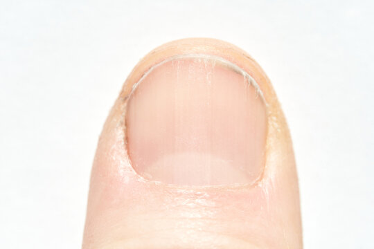 Close up of a human fingernail displaying natural texture and detail on white background.