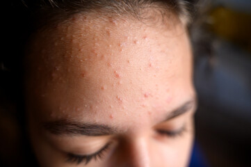Teenage girl looking at the sea horizon Oresund Sweden Danmark Landskrona