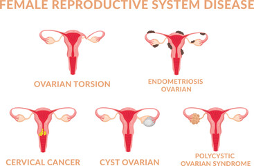 Female Reproductive System Disease, Endometriosis, Cyst, Torsion, Polycystic Ovarian Syndrome and Cervical Cancer 