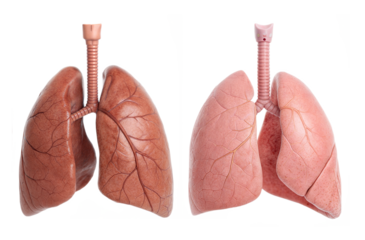 set healthy and unhealthy human lungs with pharynx and trachea, internal organs, isolated on a transparent background with a clipping path cutout.